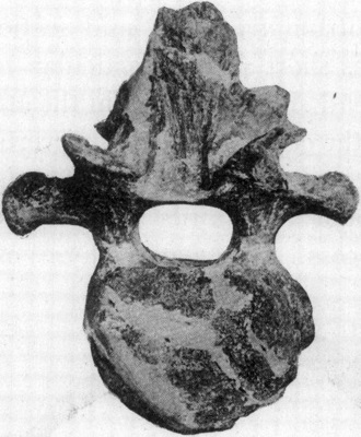 Ankylosaurus neck vertebrae